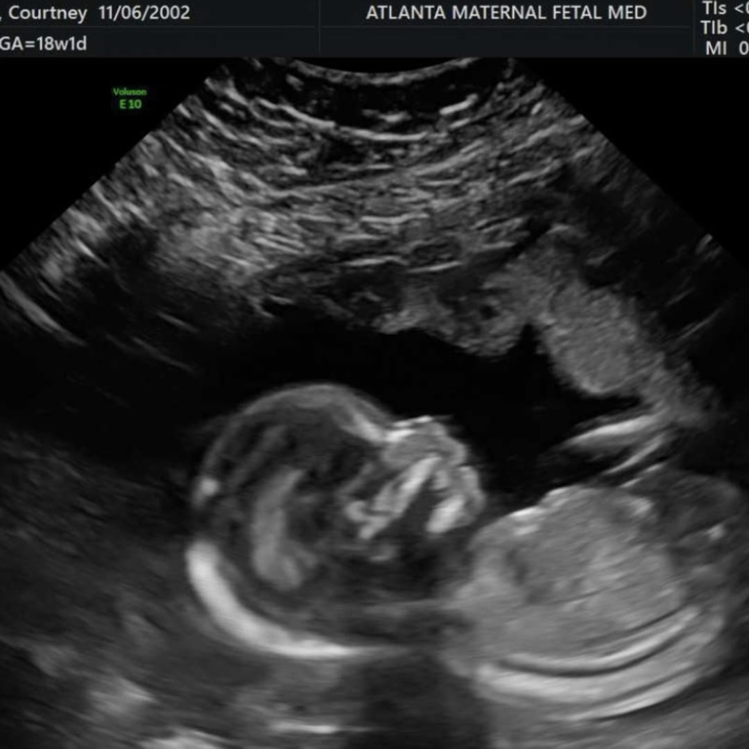 Photo shared by Courtney for their Babylist baby registry.