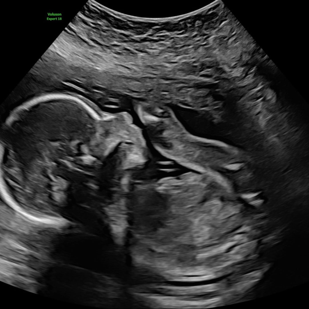 Photo shared by Jayleigh for their Babylist baby registry.