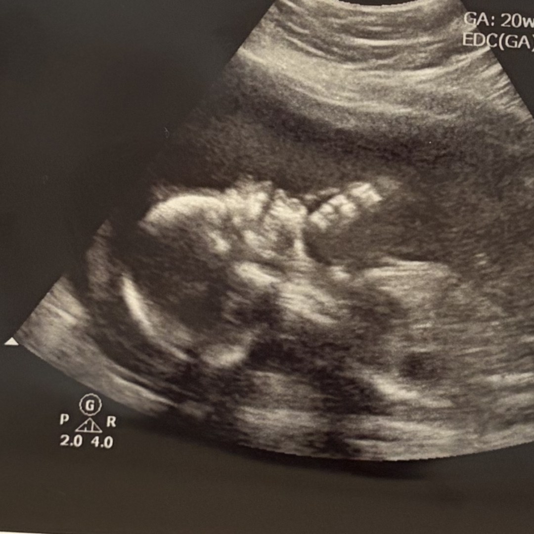 Photo shared by Sarah for their Babylist baby registry.