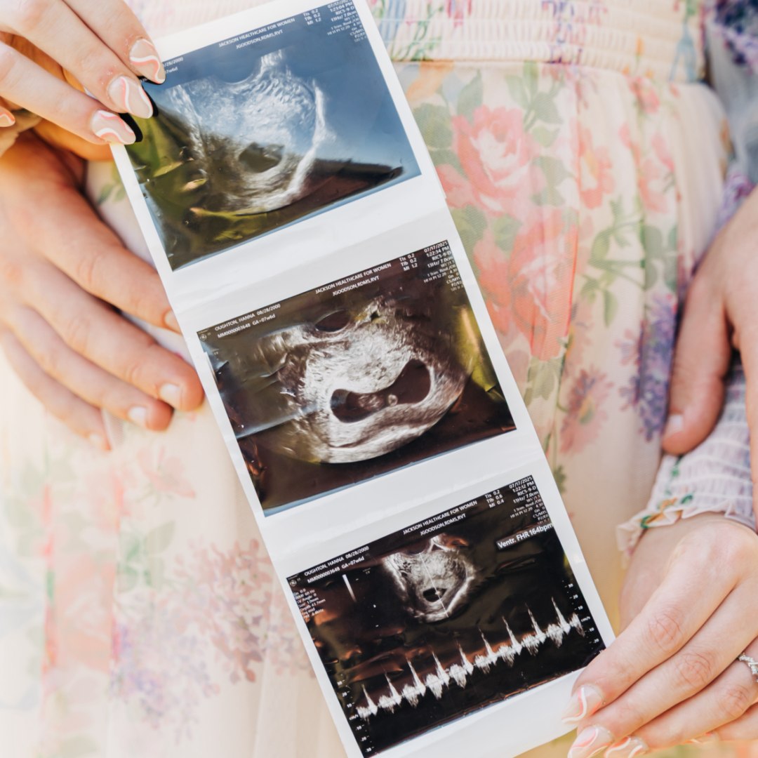 Photo shared by Hanna for their Babylist baby registry.