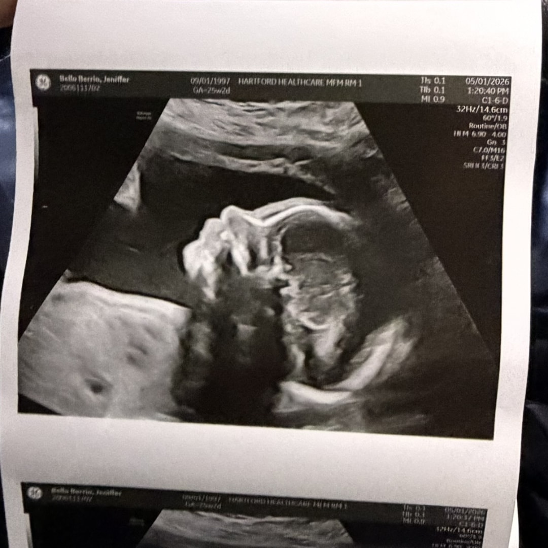 Photo shared by Rhianna for their Babylist baby registry.