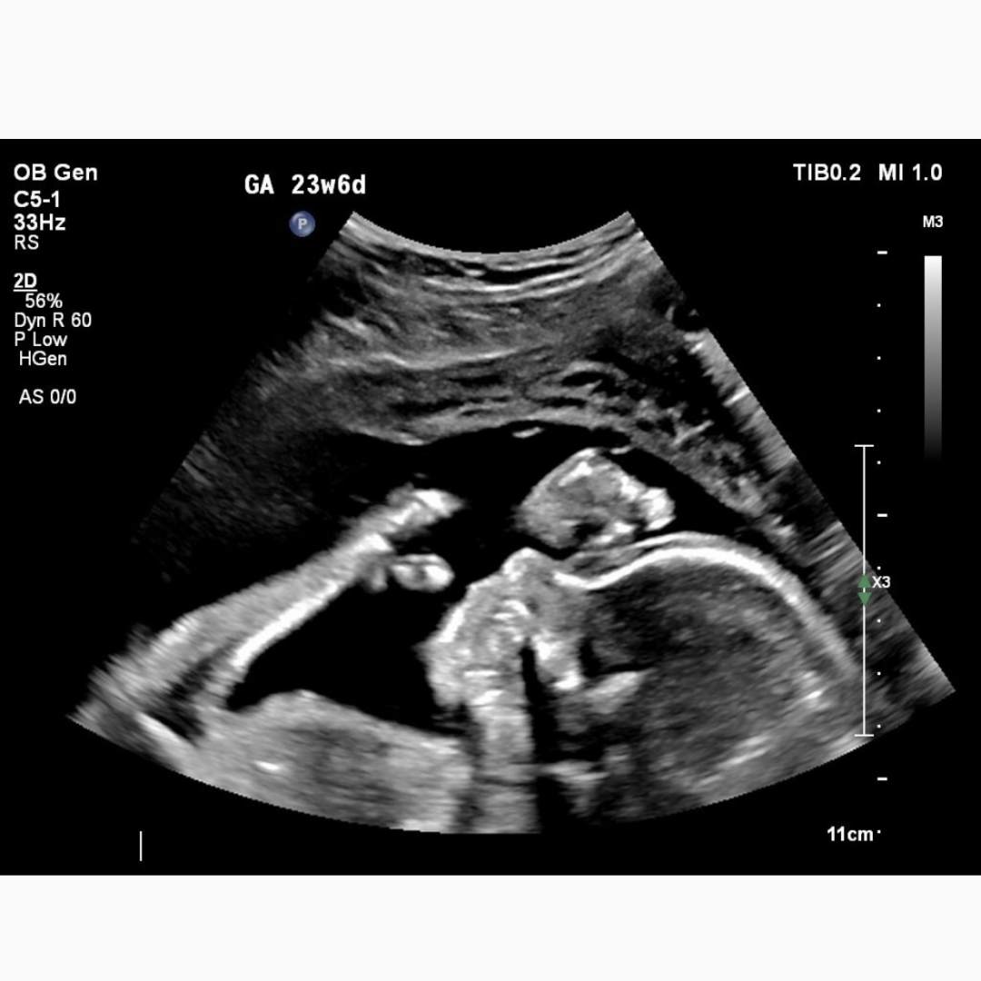 Photo shared by Sydney for their Babylist baby registry.