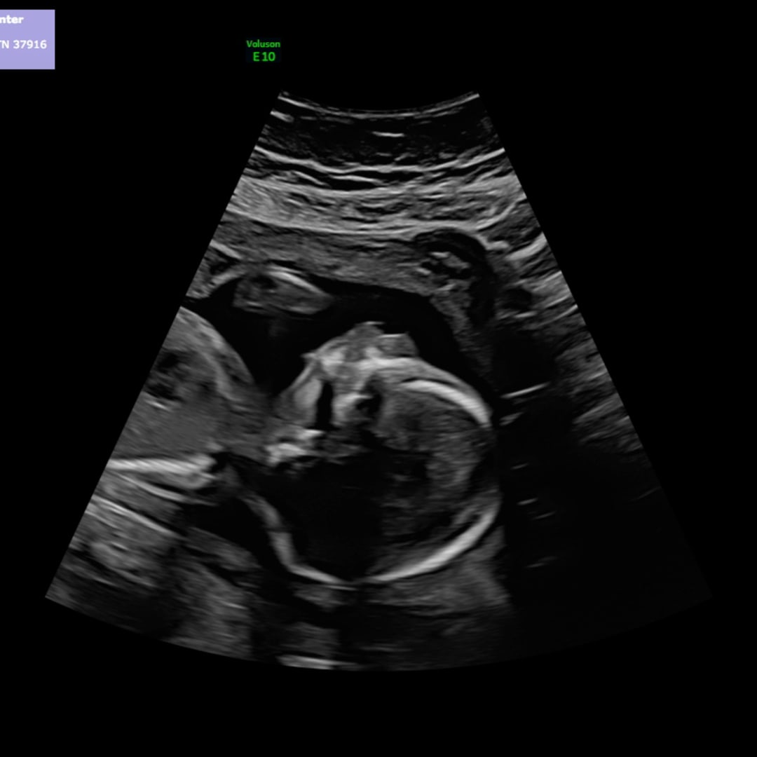 Photo shared by Grace for their Babylist baby registry.
