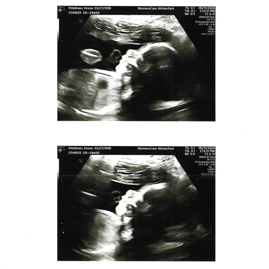 Photo shared by Emma for their Babylist baby registry.