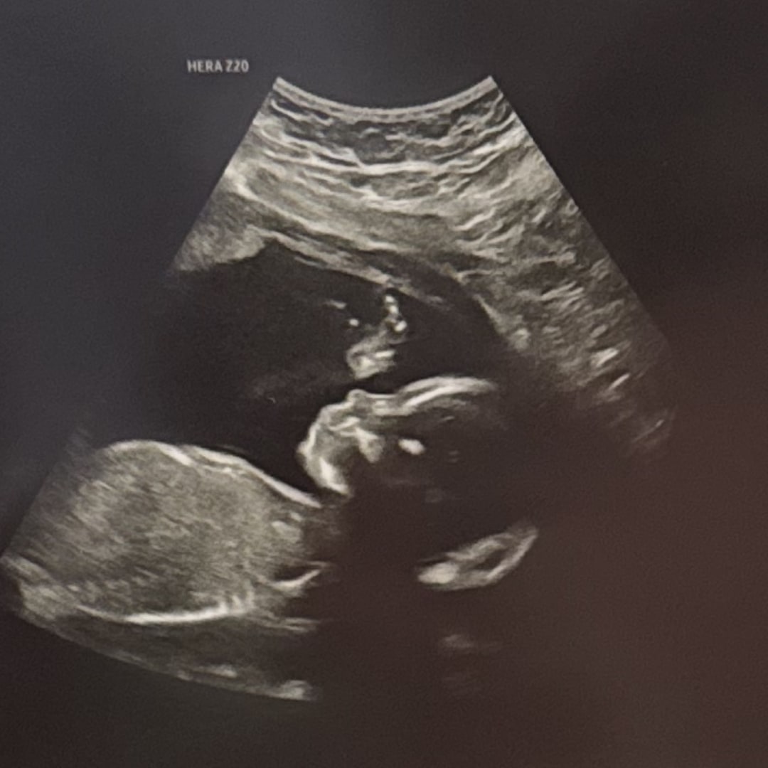 Photo shared by Estheisy for their Babylist baby registry.