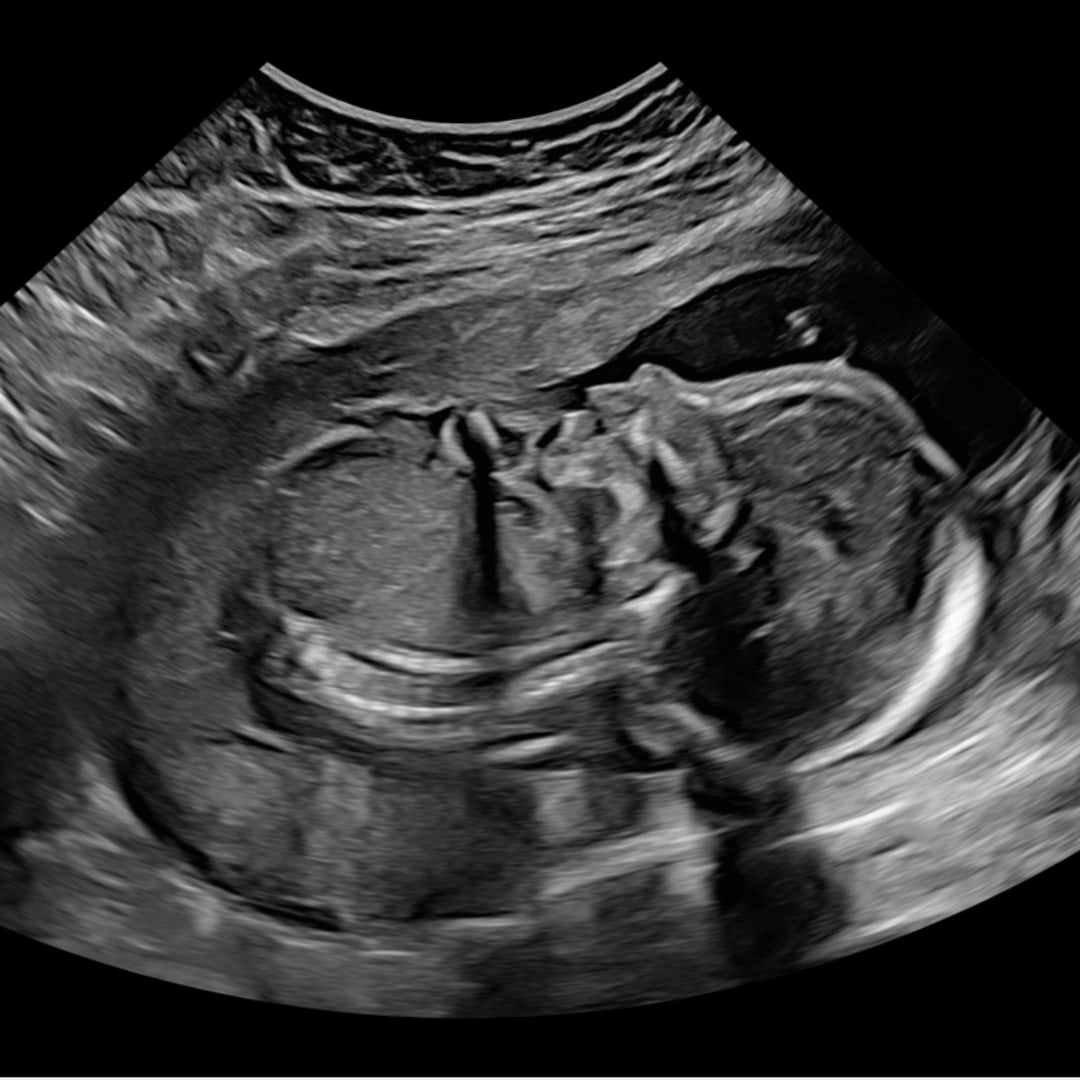 Photo shared by Kristina for their Babylist baby registry.