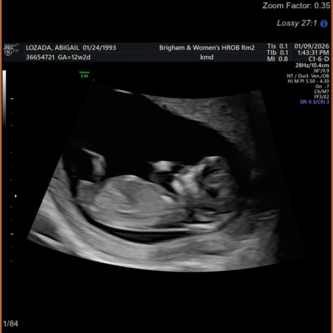 Photo shared by Abigail for their Babylist baby registry.