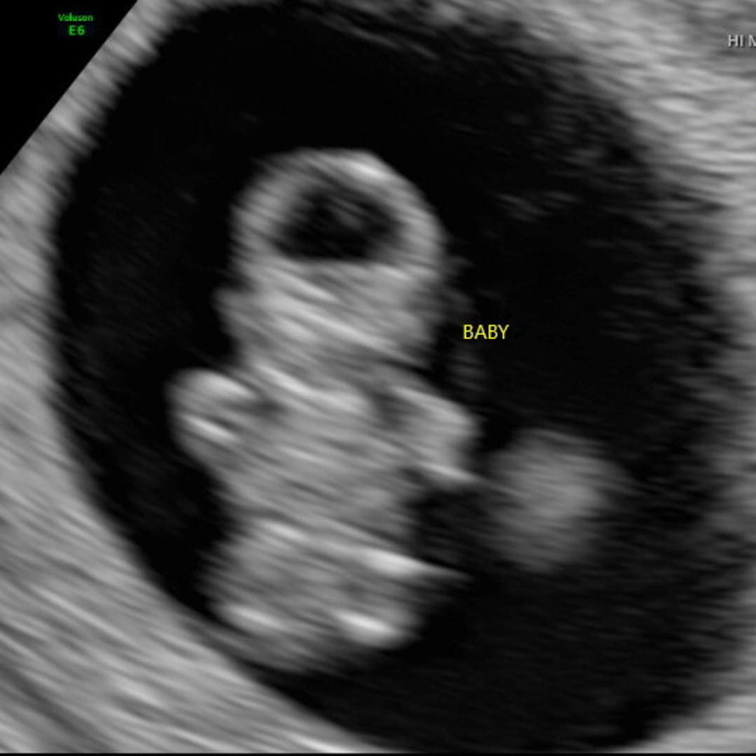 Photo shared by Allie for their Babylist baby registry.