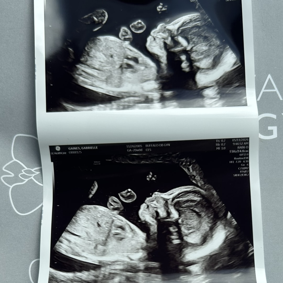 Photo shared by Gabby for their Babylist baby registry.