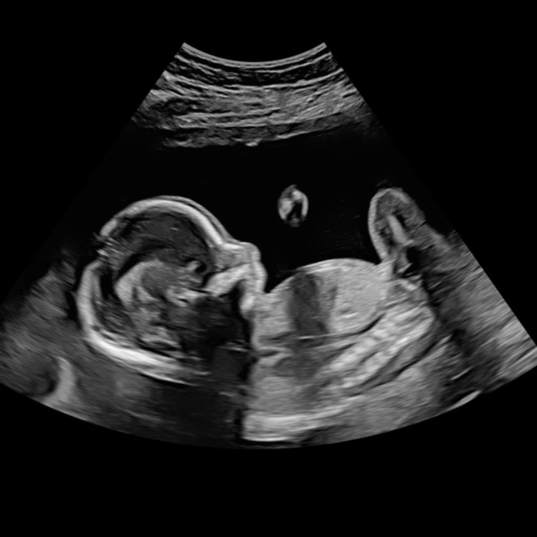Photo shared by Autumn for their Babylist baby registry.