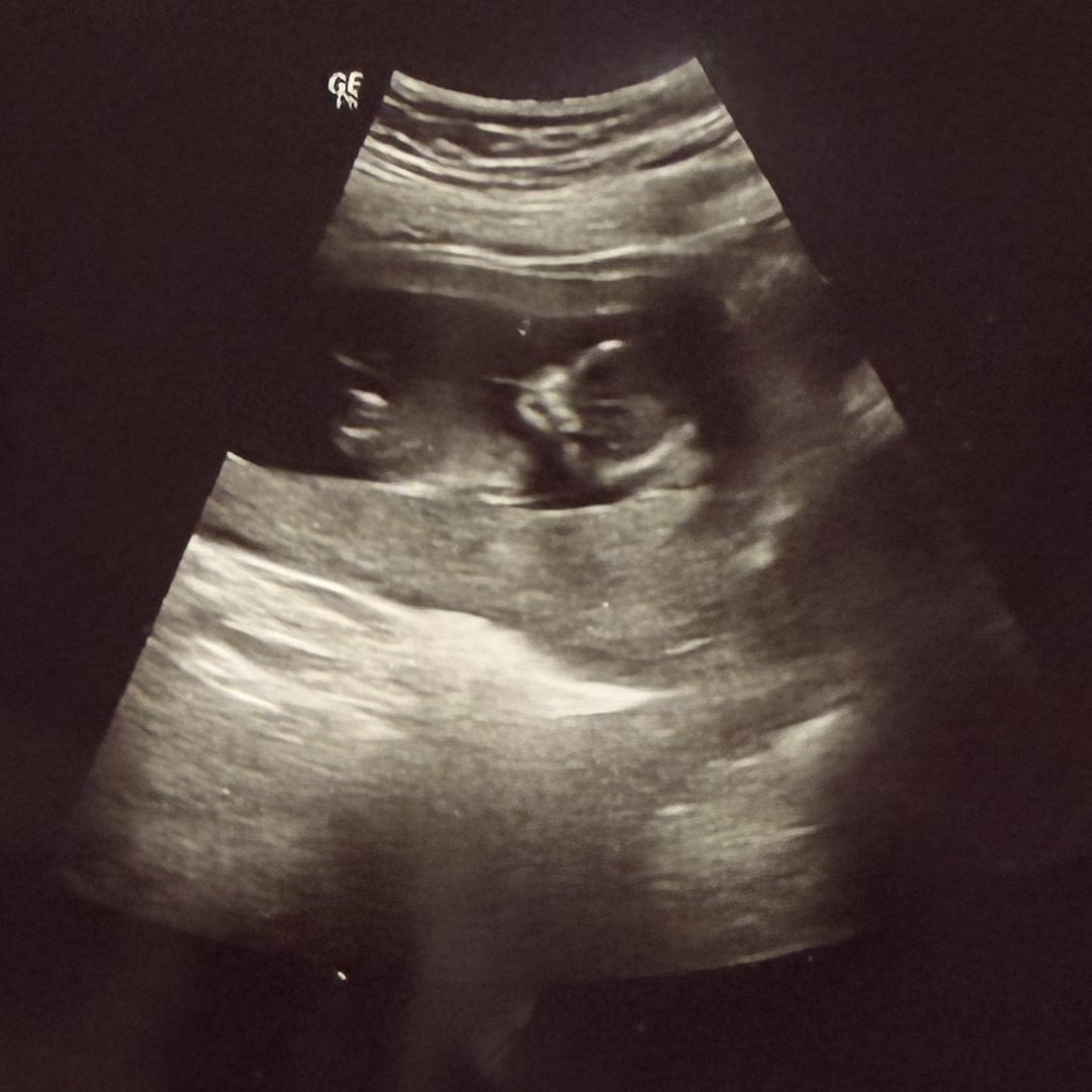 Photo shared by Veronika for their Babylist baby registry.