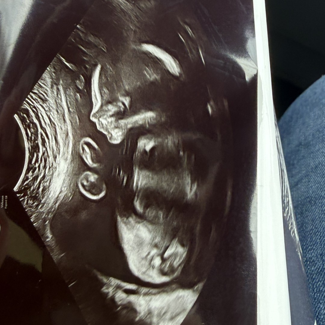 Photo shared by Quinley for their Babylist baby registry.