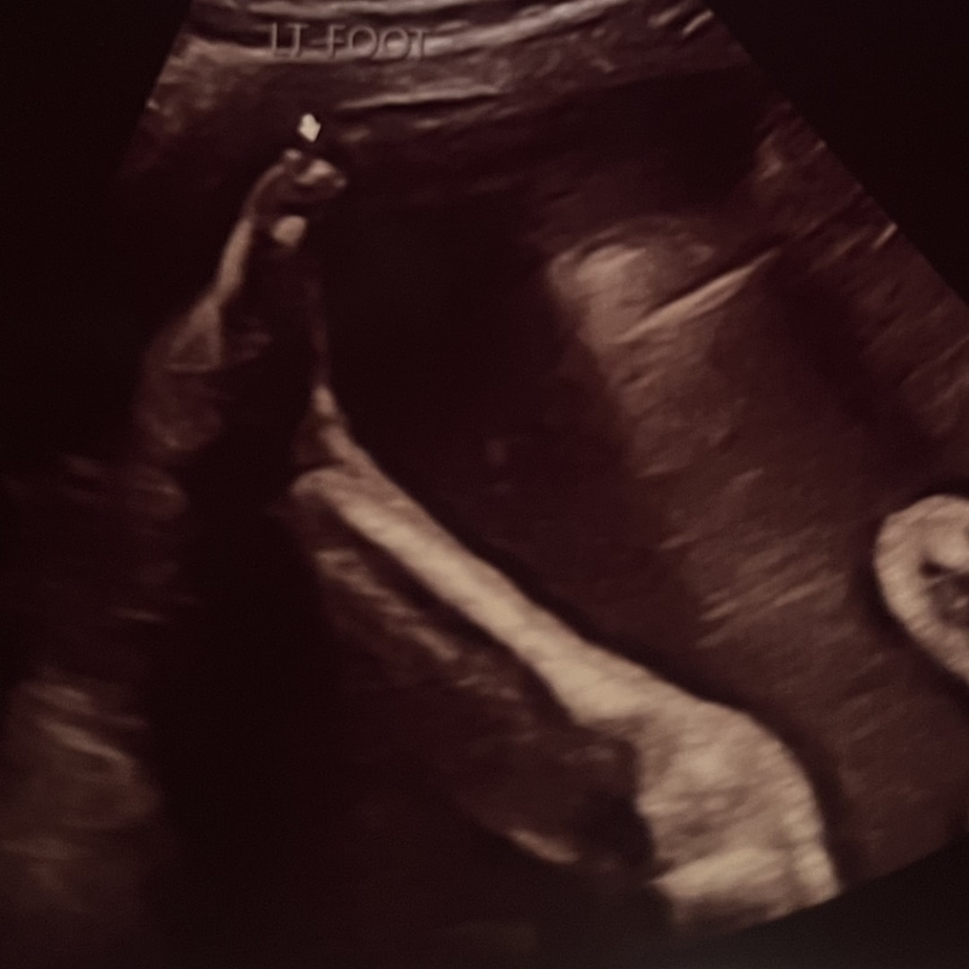 Photo shared by Morgan for their Babylist baby registry.