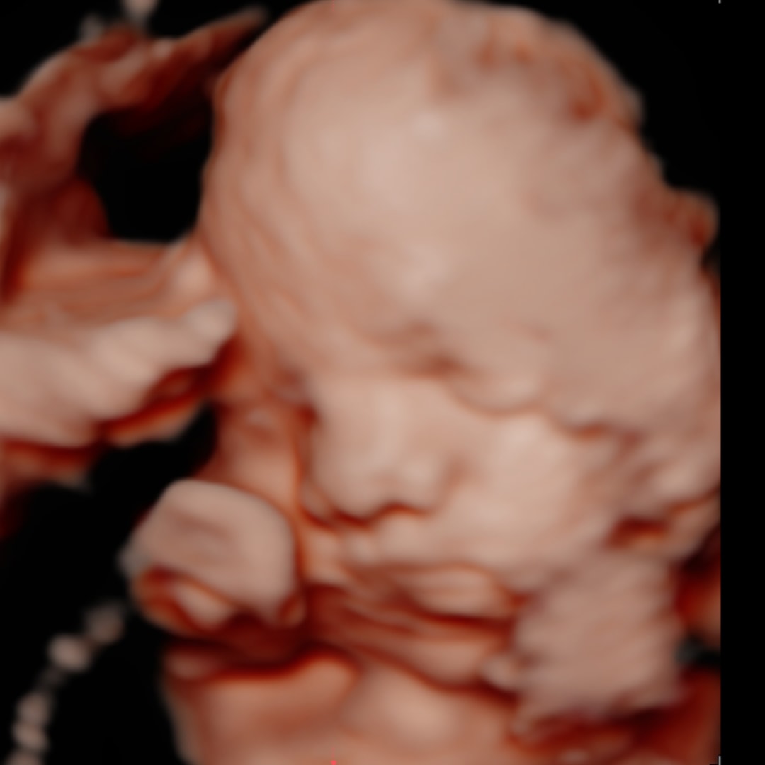 Photo shared by Madeline for their Babylist baby registry.