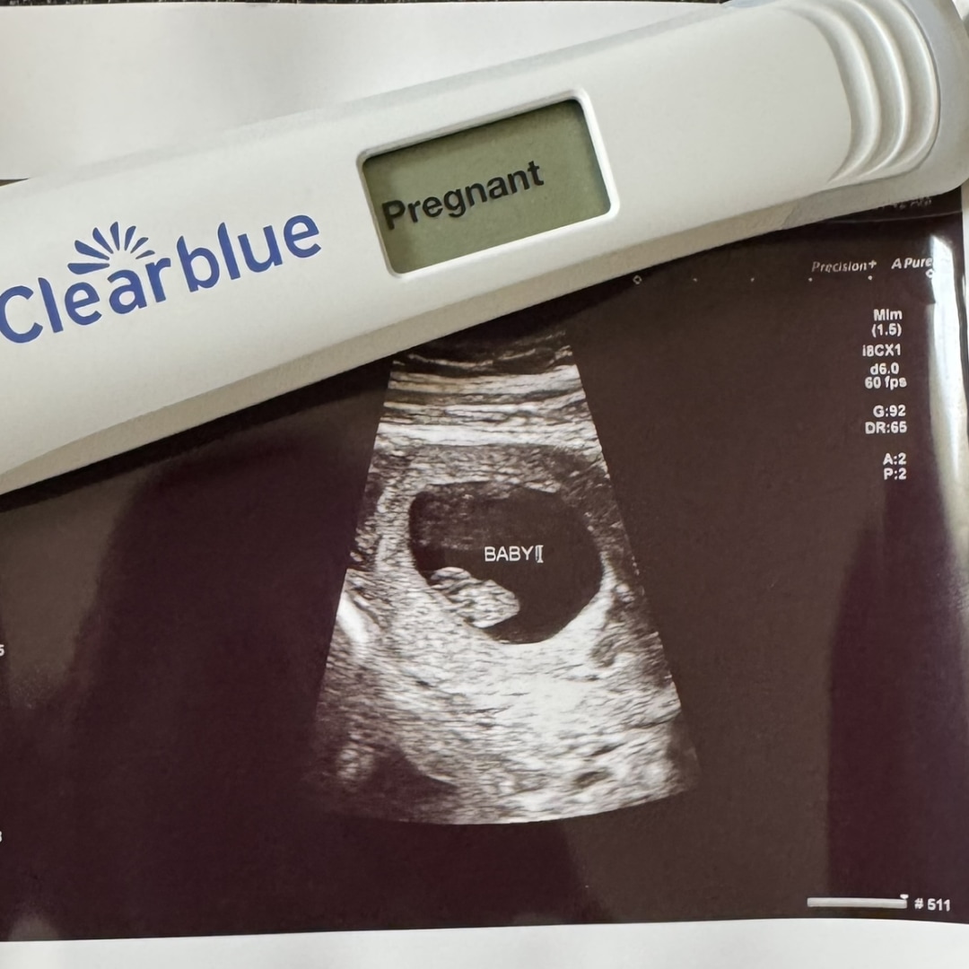 Photo shared by Kirstyn for their Babylist baby registry.