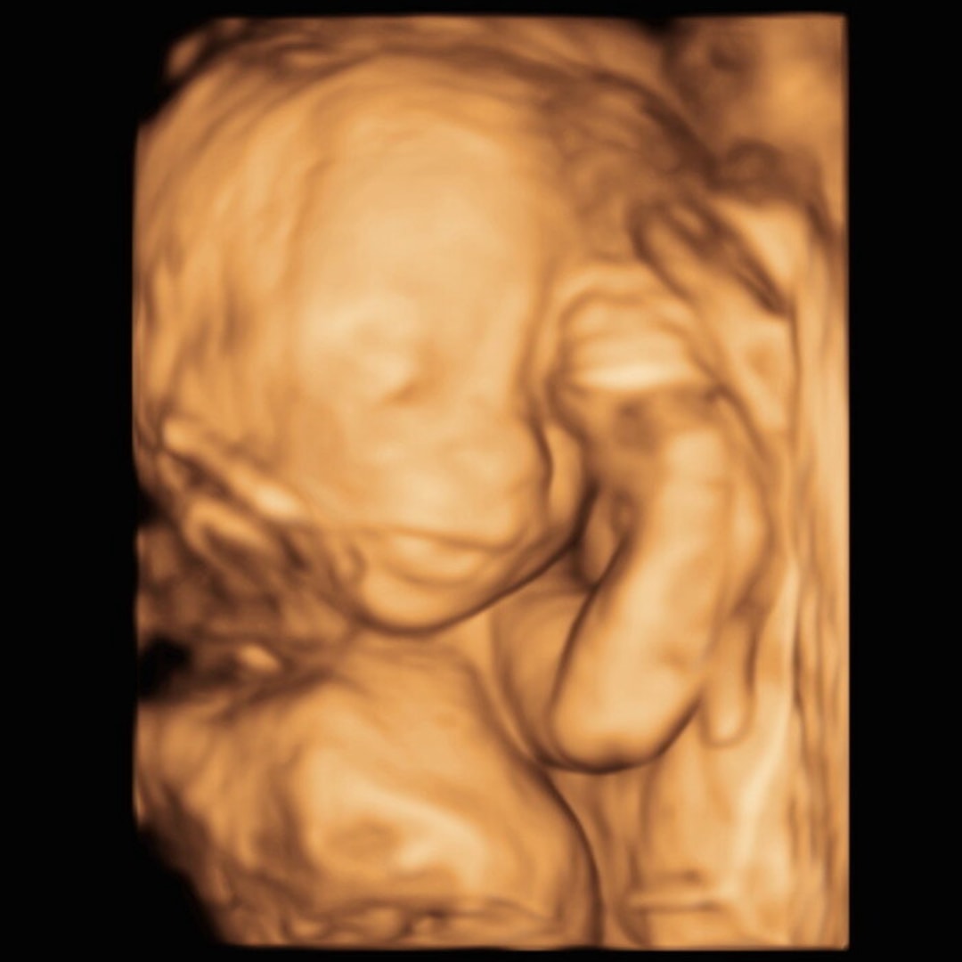 Photo shared by Catherine for their Babylist baby registry.