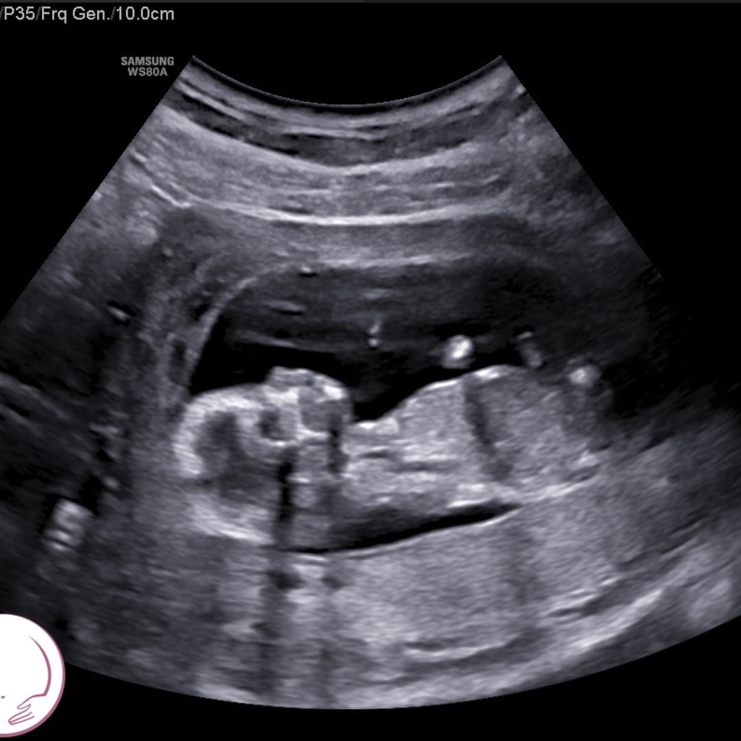 Photo shared by Em for their Babylist baby registry.