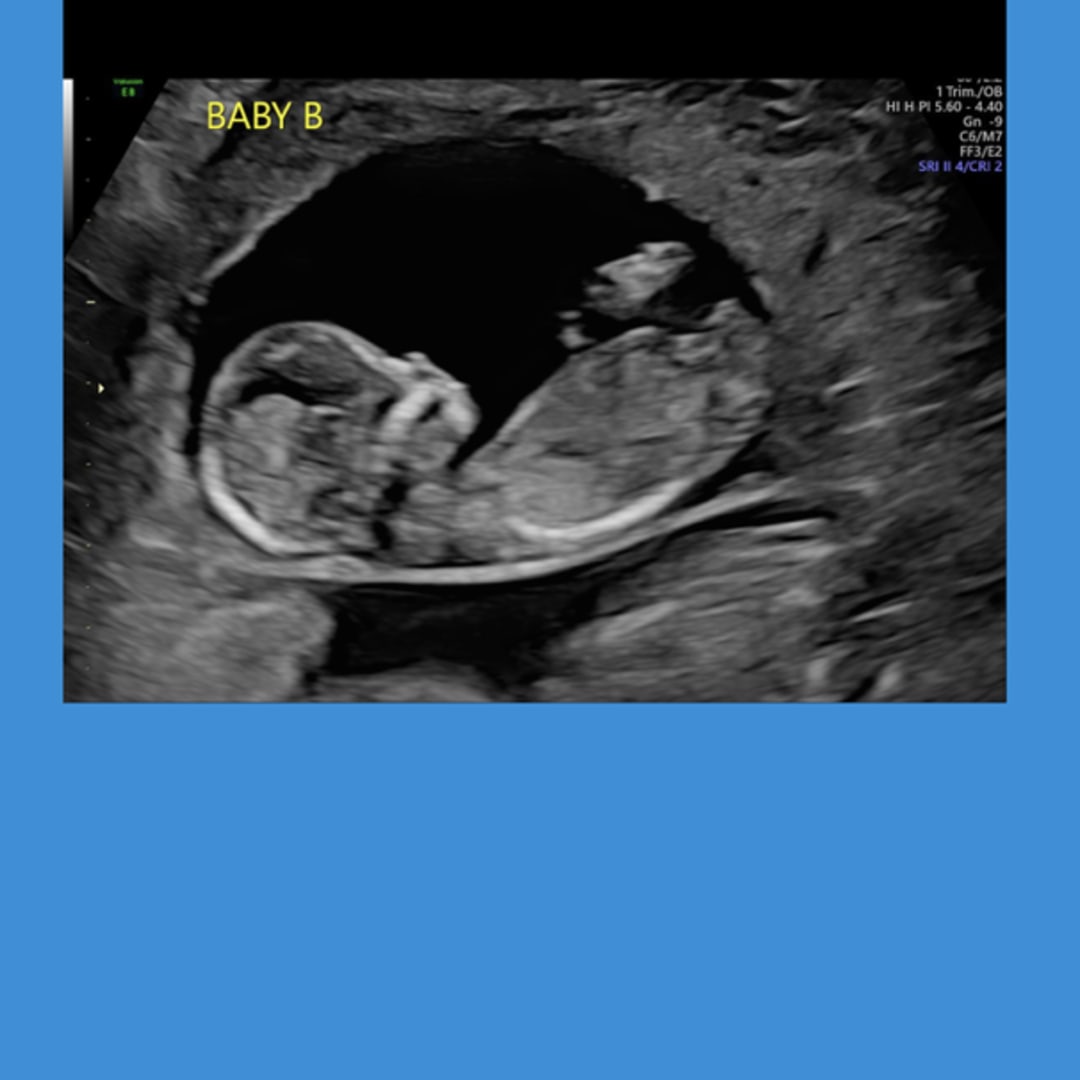 Photo shared by Emily for their Babylist baby registry.