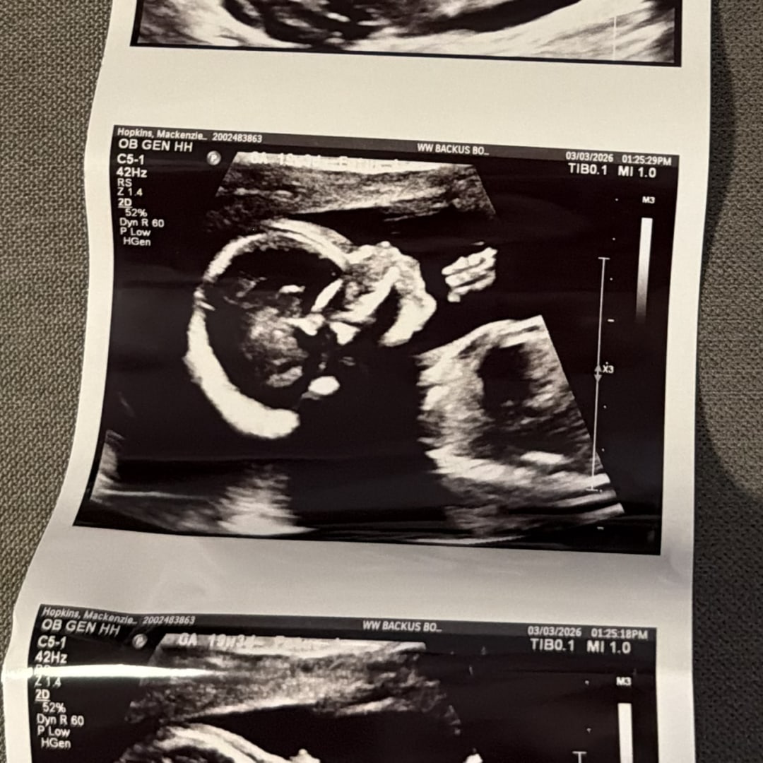 Photo shared by Mackenzie for their Babylist baby registry.