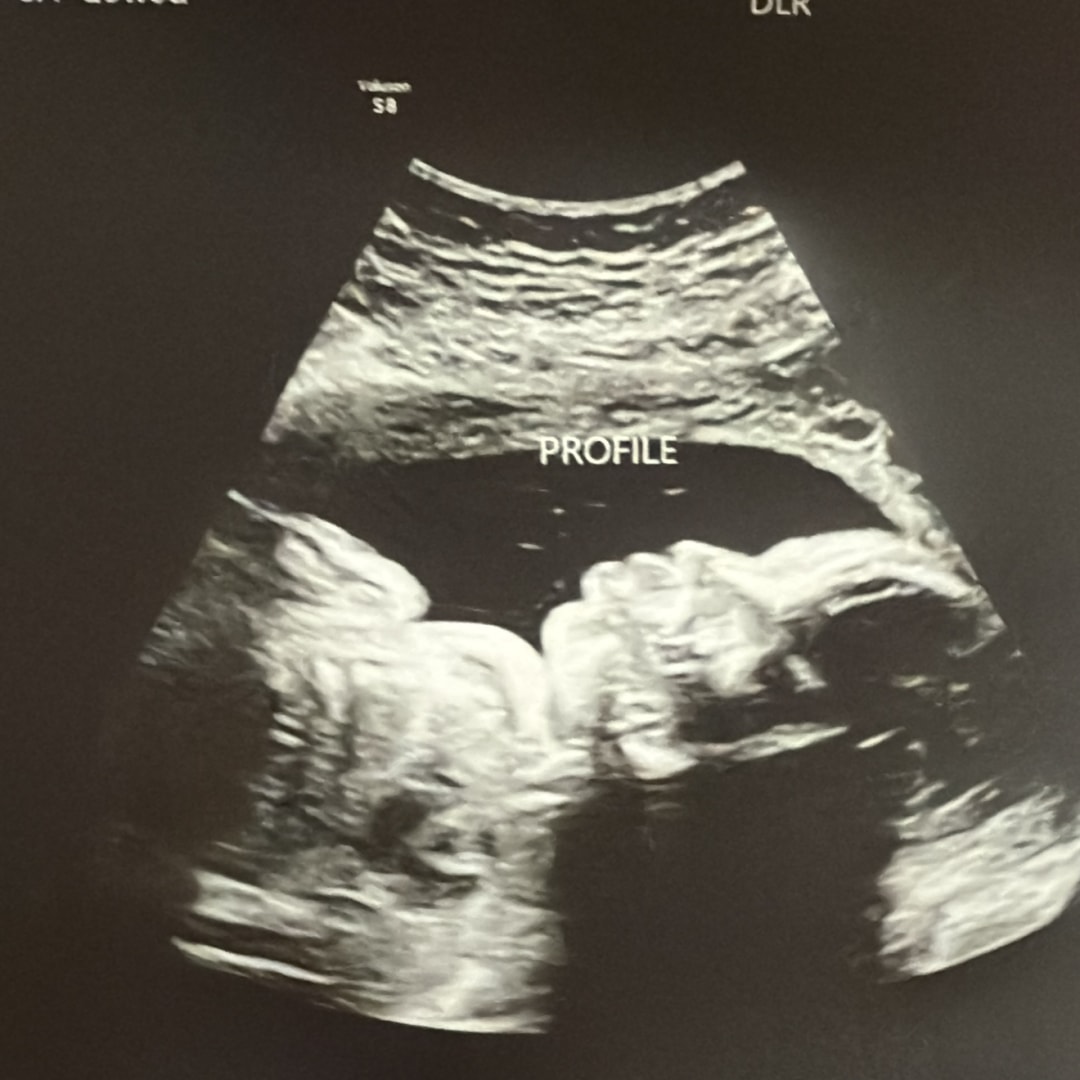 Photo shared by Maria for their Babylist baby registry.