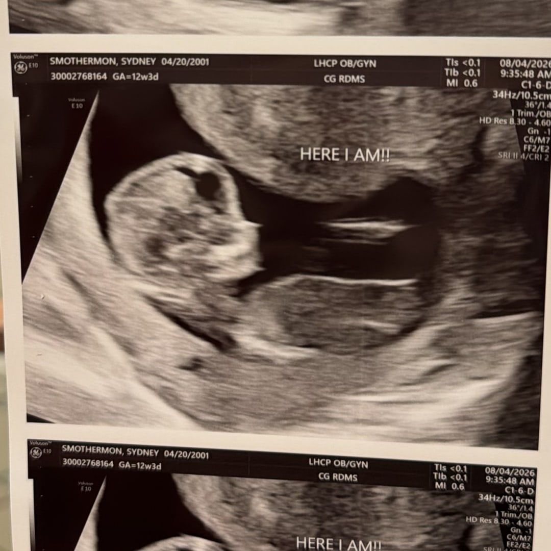 Photo shared by Sydney for their Babylist baby registry.