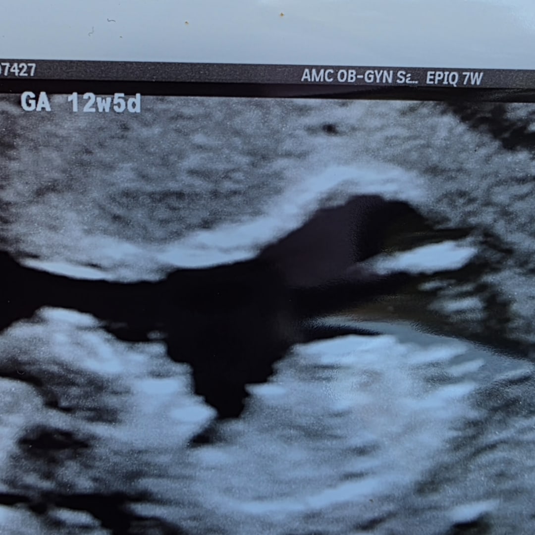 Photo shared by Haylie-Morgan for their Babylist baby registry.