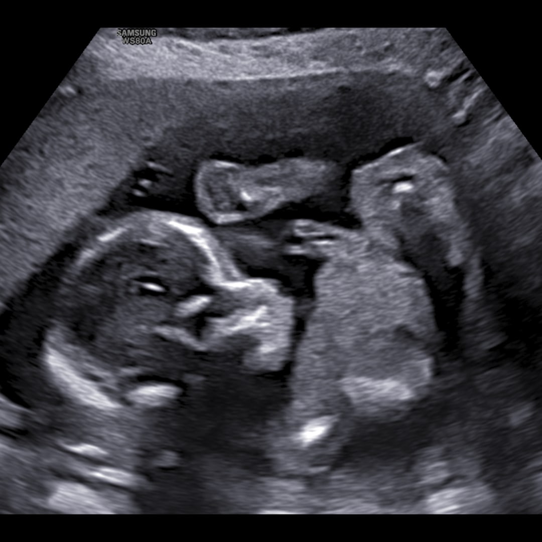 Photo shared by Shannon for their Babylist baby registry.