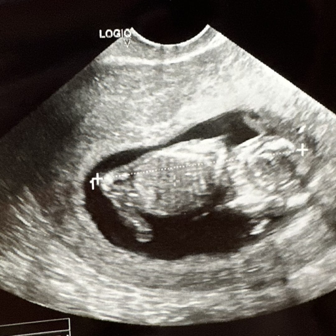 Photo shared by Allison for their Babylist baby registry.