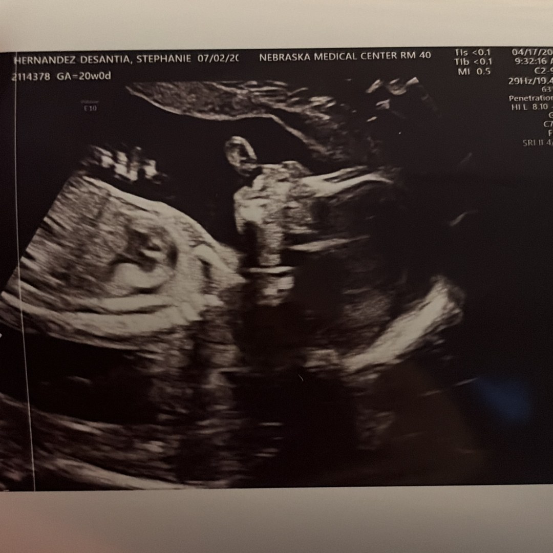Photo shared by Stephanie for their Babylist baby registry.