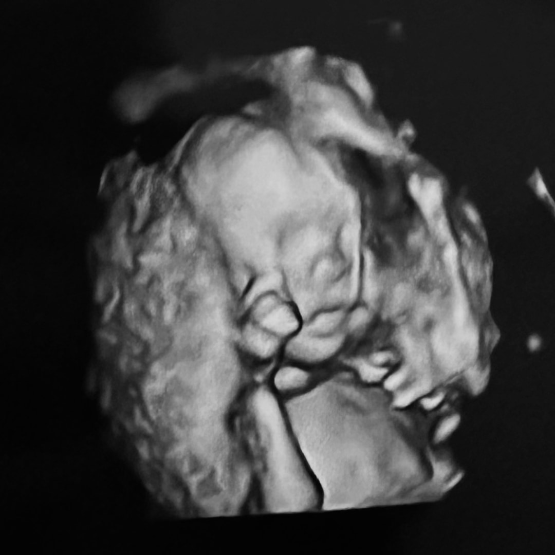 Photo shared by Asmel for their Babylist baby registry.