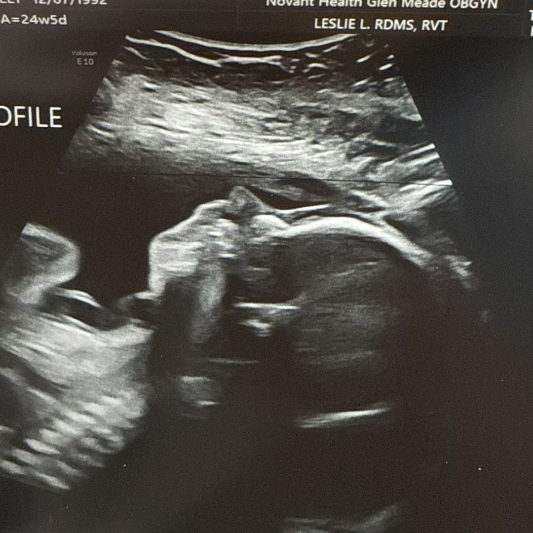 Photo shared by Holly for their Babylist baby registry.