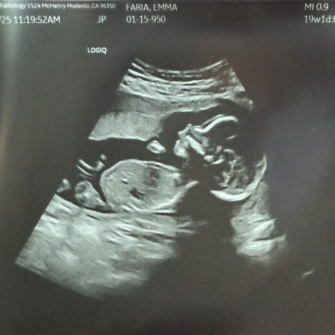 Photo shared by Emma for their Babylist baby registry.