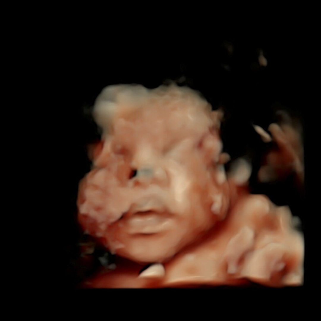 Photo shared by Angel for their Babylist baby registry.