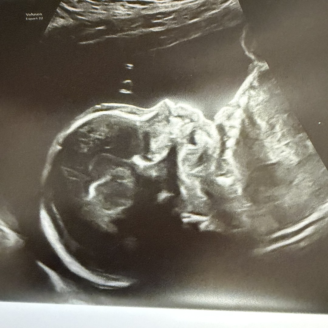 Photo shared by Isabel for their Babylist baby registry.