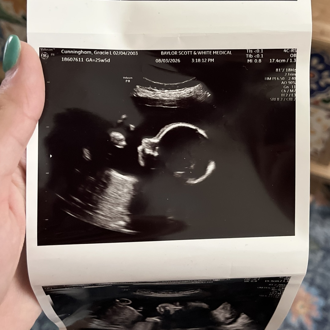 Photo shared by Gracie for their Babylist baby registry.