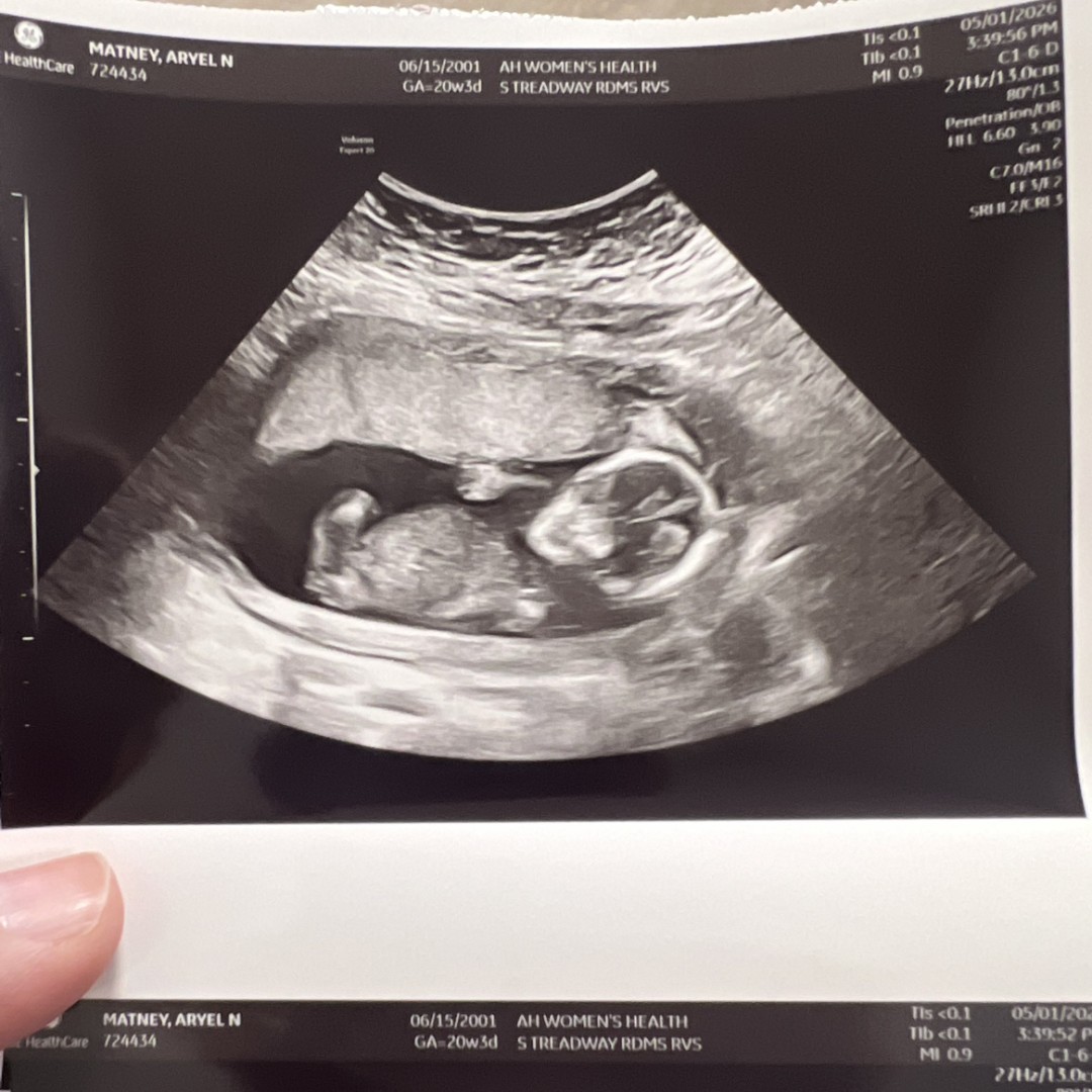Photo shared by Aryel for their Babylist baby registry.