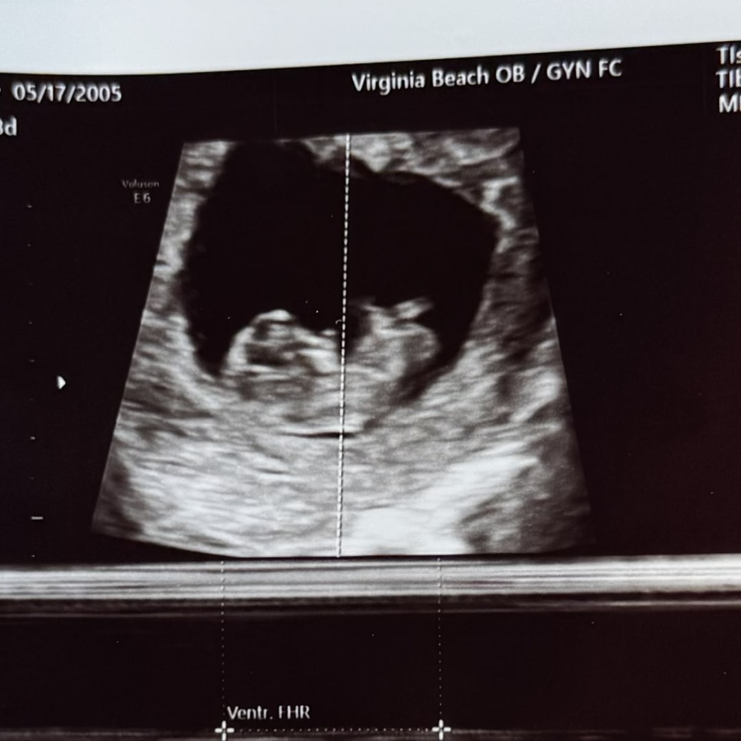 Photo shared by Casey for their Babylist baby registry.