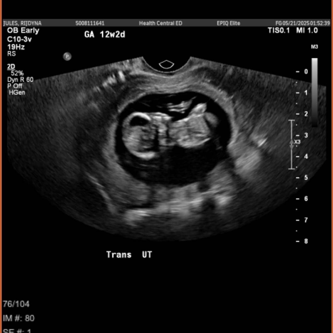 Photo shared by Rijdyna for their Babylist baby registry.