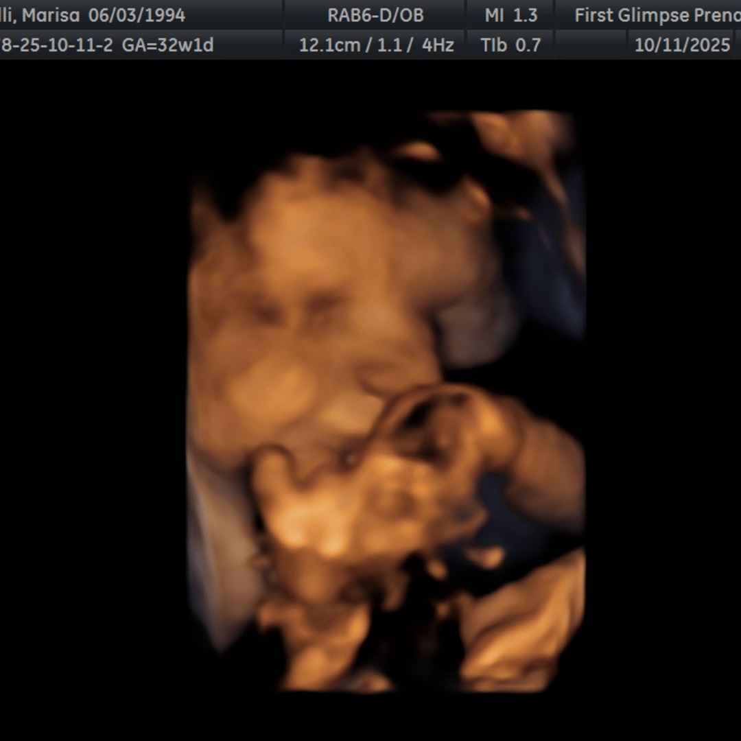 Photo shared by Marisa for their Babylist baby registry.