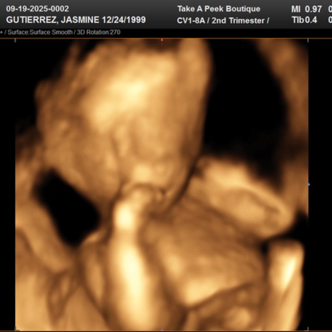 Photo shared by Jasmine for their Babylist baby registry.