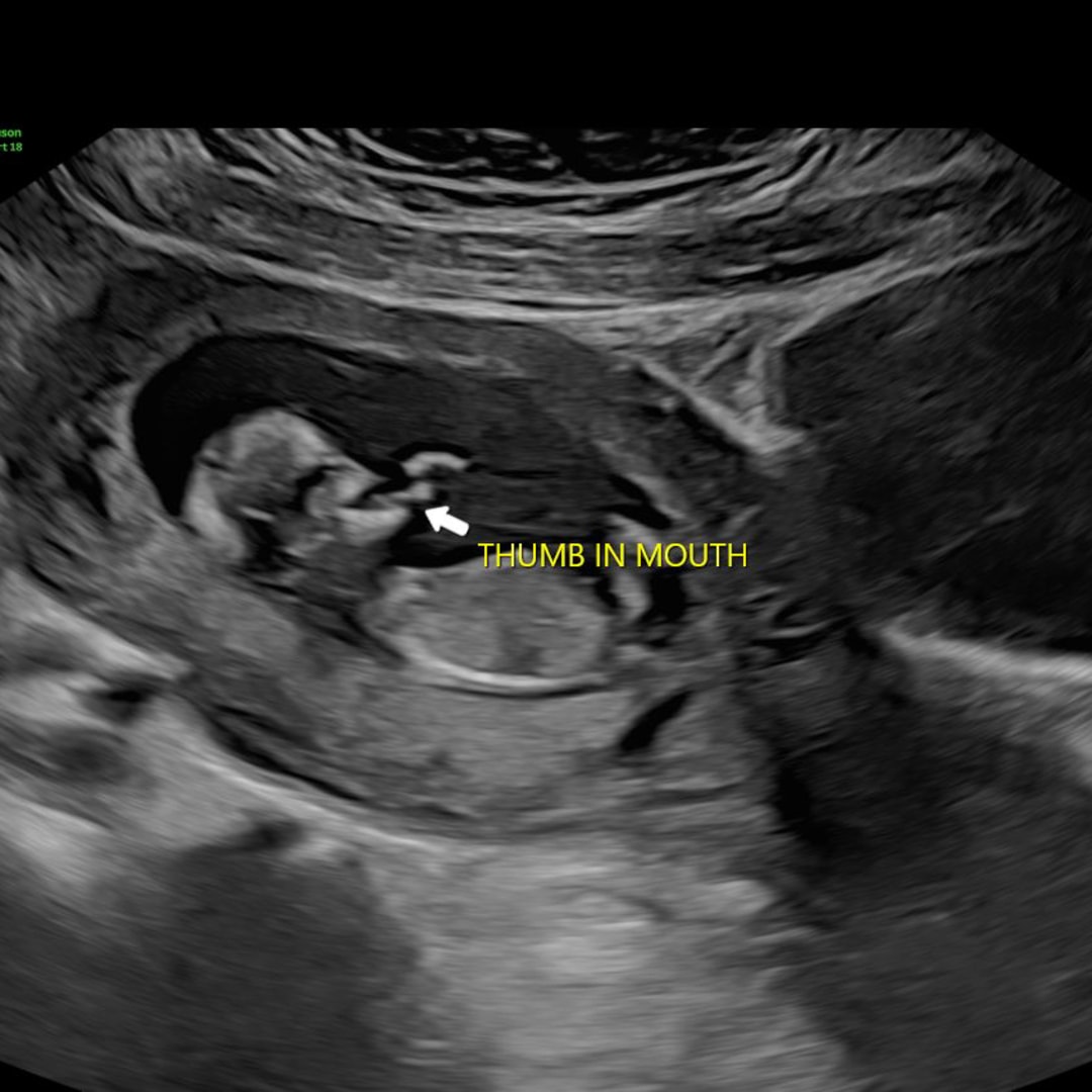 Photo shared by Caitlin for their Babylist baby registry.