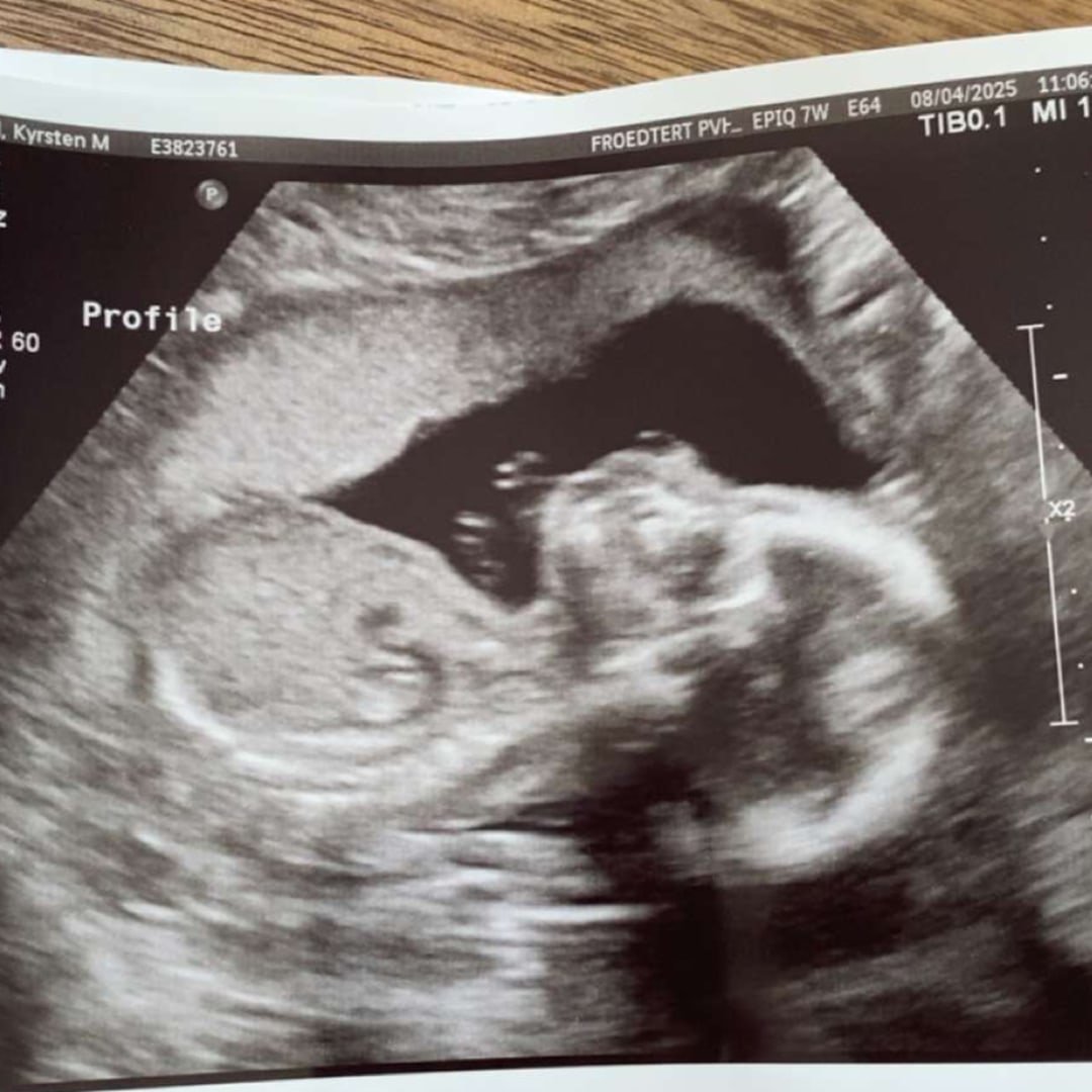 Photo shared by Cody for their Babylist baby registry.