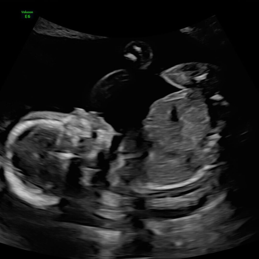 Photo shared by Gabriela for their Babylist baby registry.