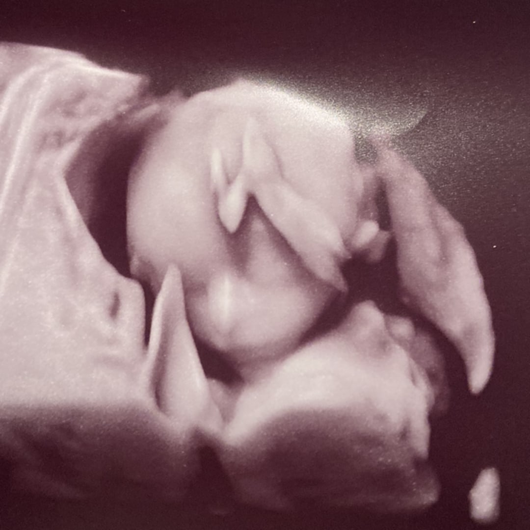 Photo shared by Abby for their Babylist baby registry.