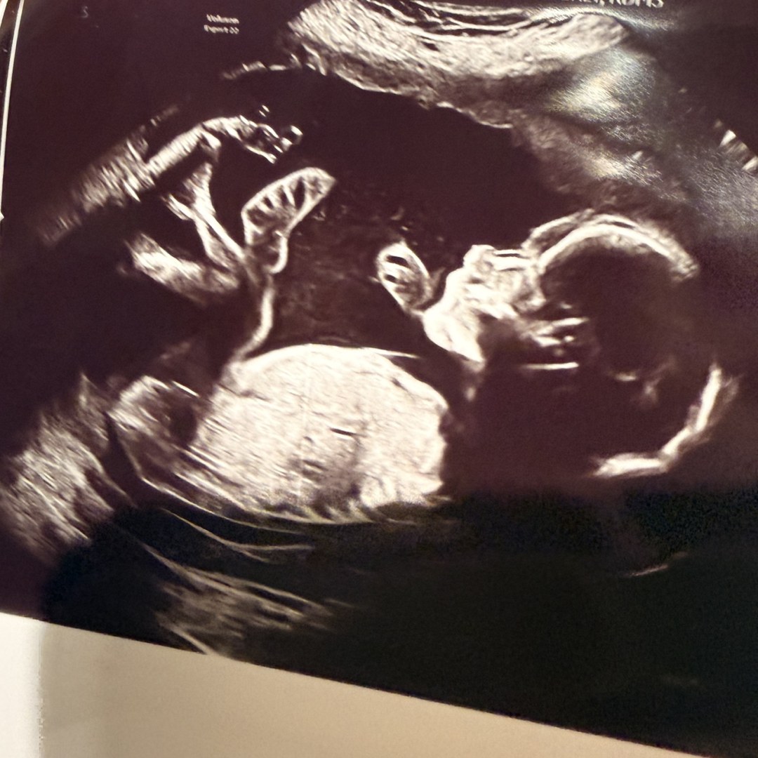 Photo shared by Mary for their Babylist baby registry.