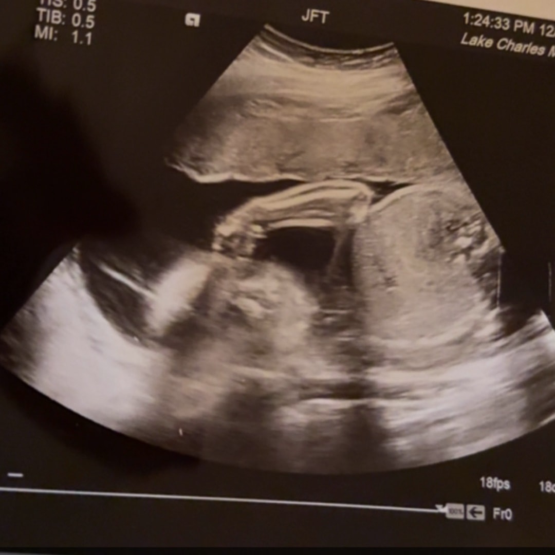 Photo shared by Amber for their Babylist baby registry.