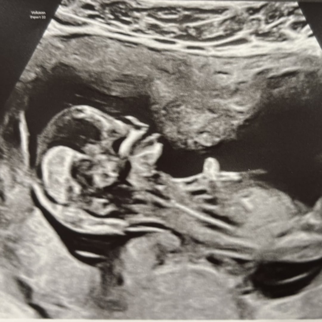 Photo shared by Selena for their Babylist baby registry.