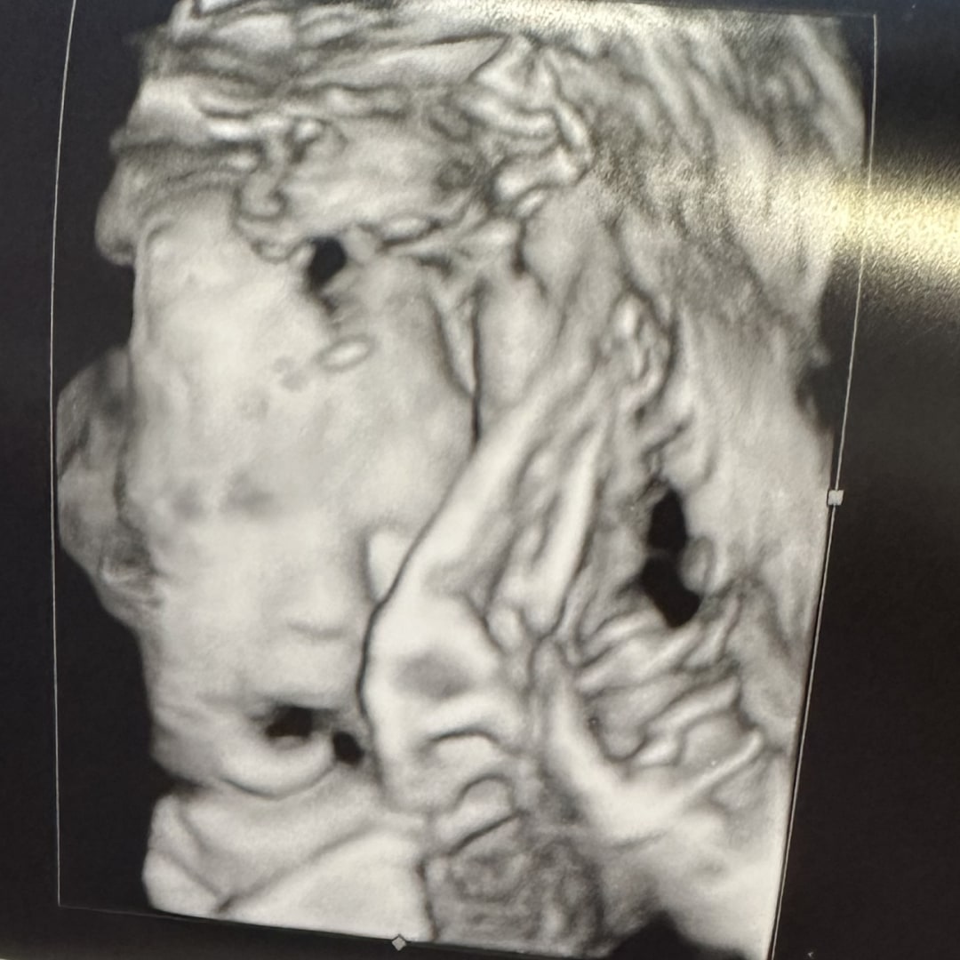 Photo shared by Lauren for their Babylist baby registry.