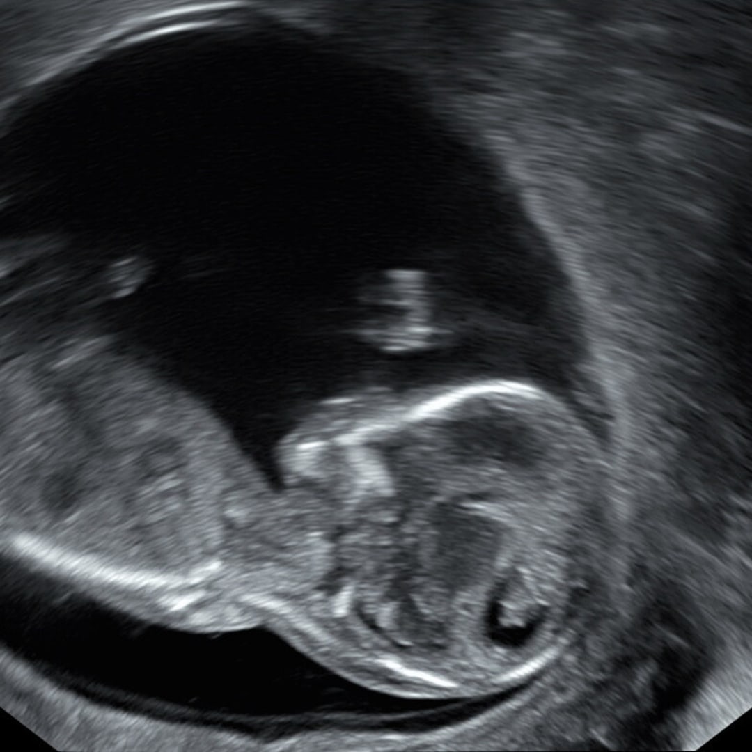 Photo shared by Jessica for their Babylist baby registry.