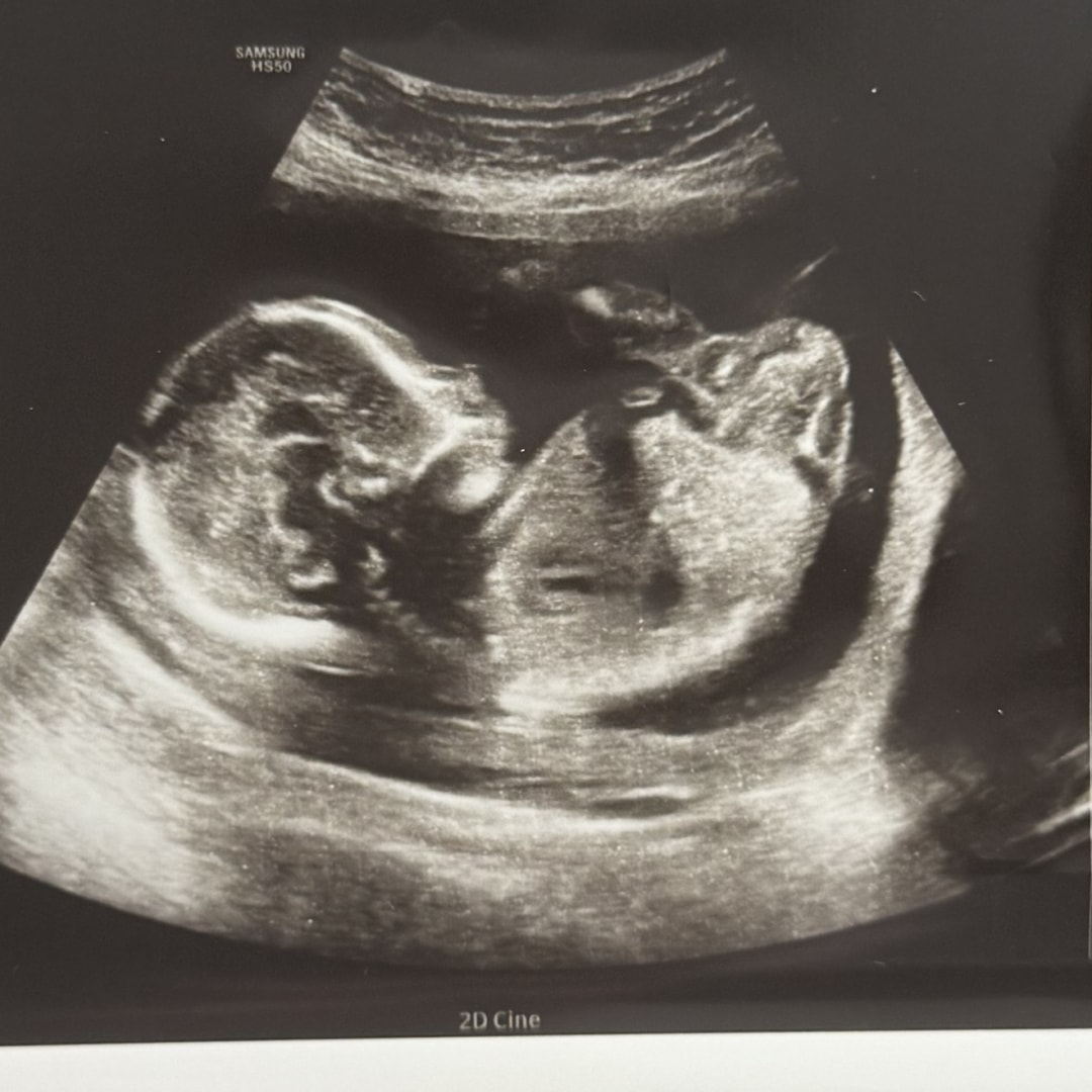 Photo shared by Brooke for their Babylist baby registry.